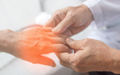 Why Your Orthopedist Cares About Osteoporosis: Ensuring Bone Health for a Stronger Future