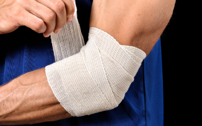 All You Need to Know About an Elbow Fracture