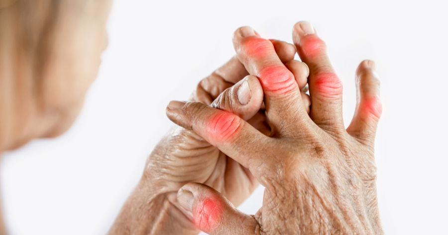 How Can I Reverse My Arthritis?